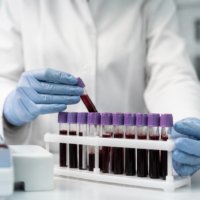 Як вибрати лабораторію і отримати достовірні аналізи
